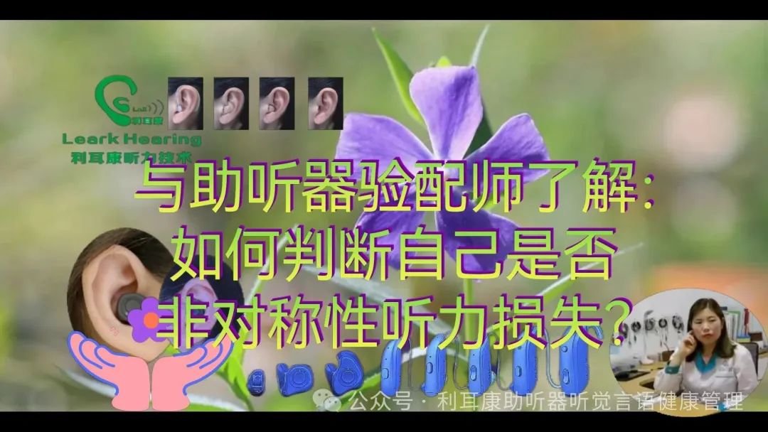 耳声发射图怎么看与助听器验配师了解：如何判断自己是否非对称性听力损失？_https://www.jmylbn.com_新闻资讯_第1张